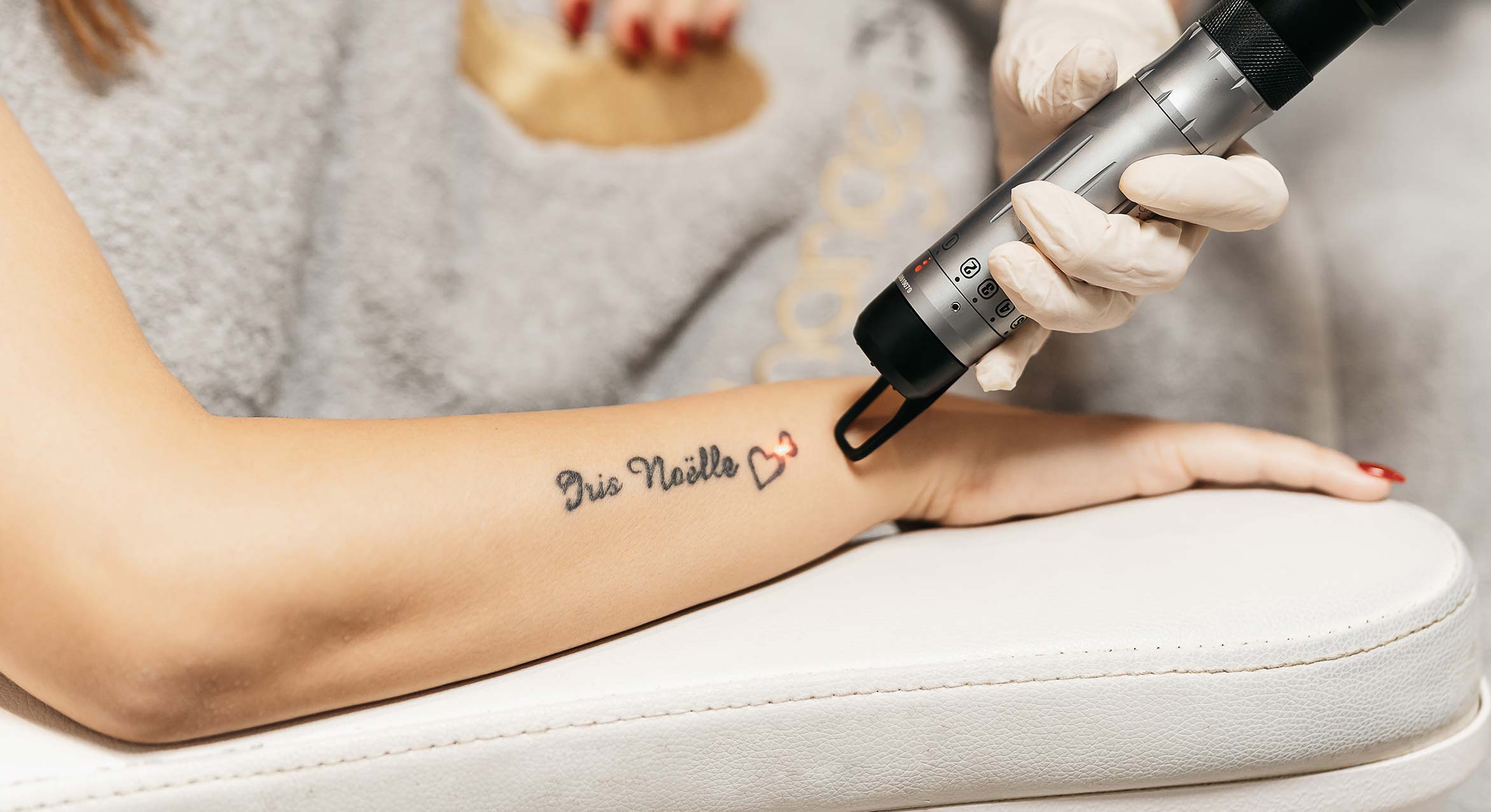 change-laserclinic-laserbehandeling-tattoo-verwijderen